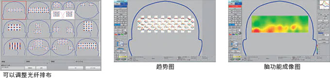 操作简单