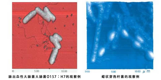 O157型大肠杆菌的显微镜观察| 岛津分析检测