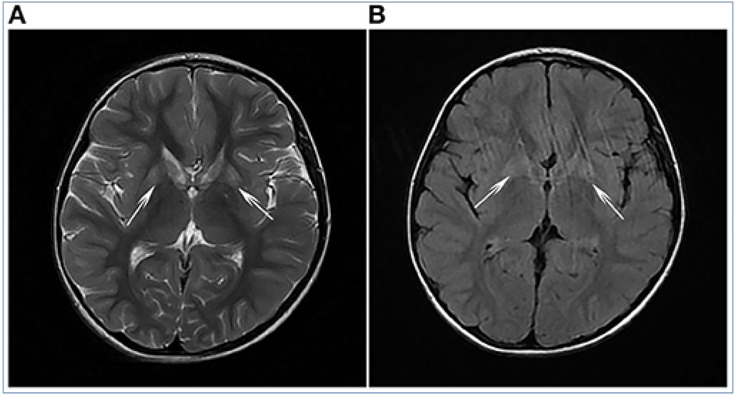 20250319-journal5-img14