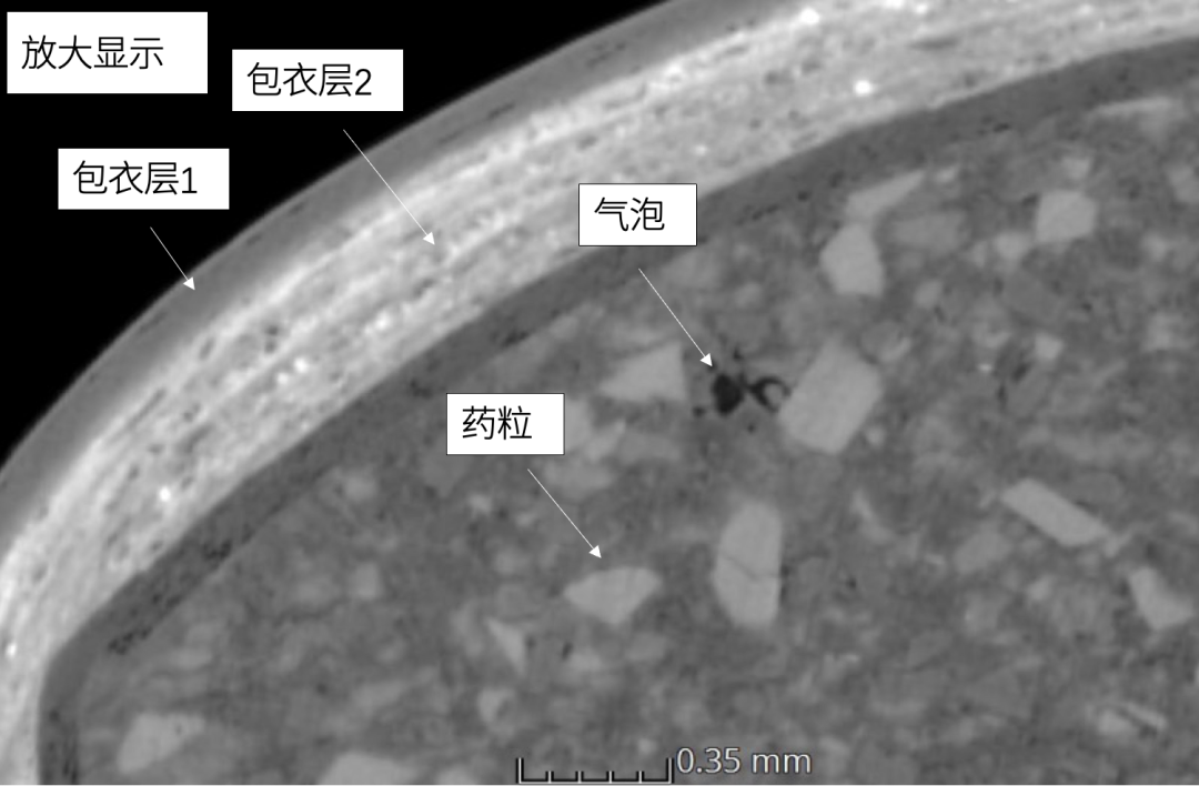 断层扫描