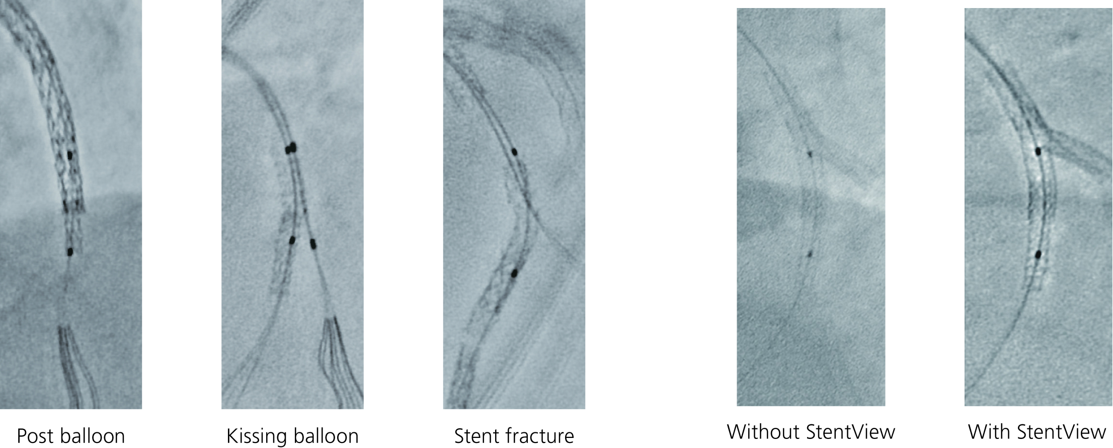 Real-Time Functionality Required for PCI