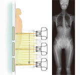 Slot Radiography